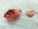 陰睾の腫瘍化 (3)